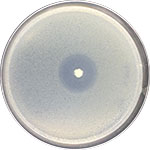 Vibrio alginolyticus